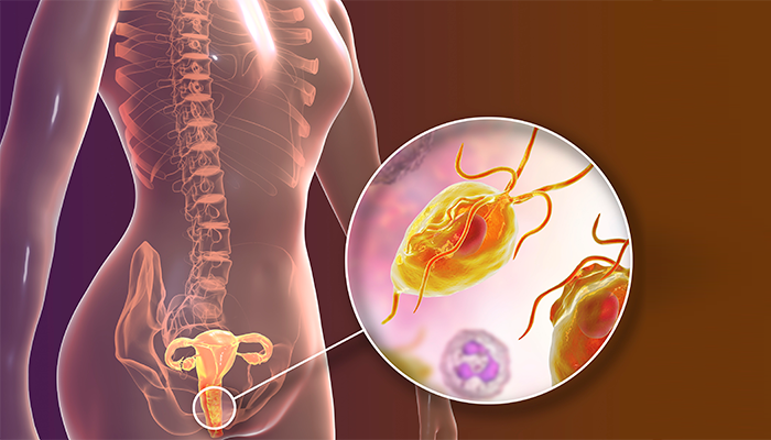 Fotografía para artículo sobre la cervicitis, para el blog de topfarma.